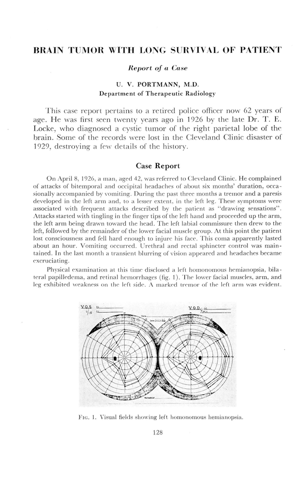 PDF extract preview