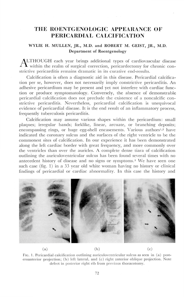 PDF extract preview