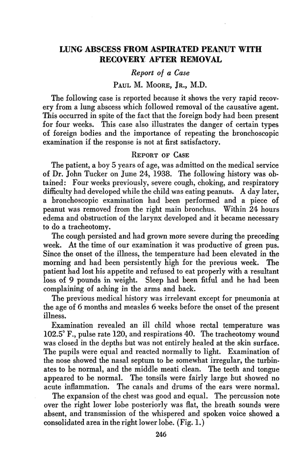 PDF extract preview