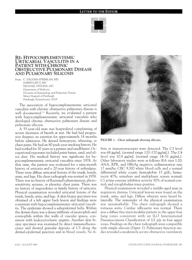 PDF extract preview