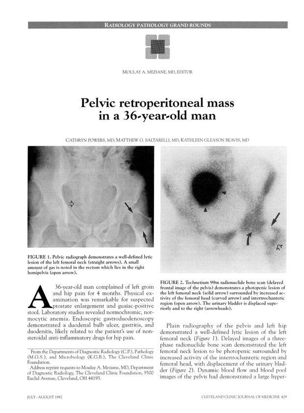 PDF extract preview