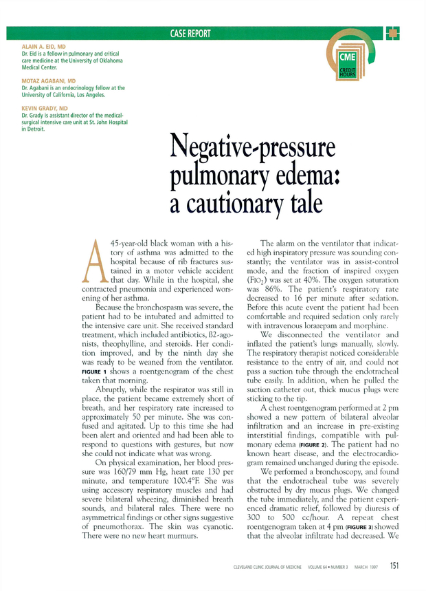 PDF extract preview