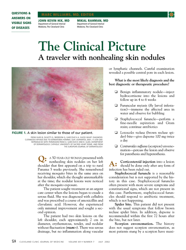PDF extract preview