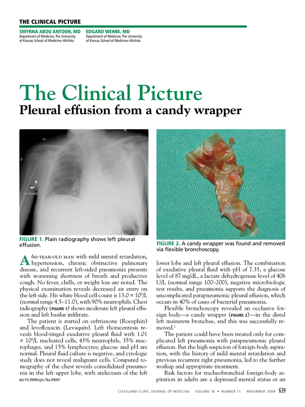 PDF extract preview