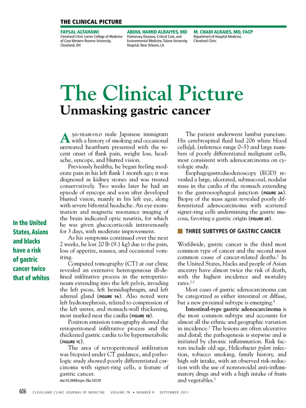 PDF extract preview