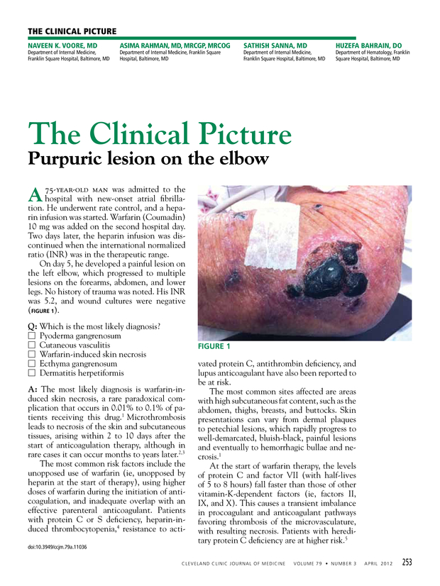 PDF extract preview