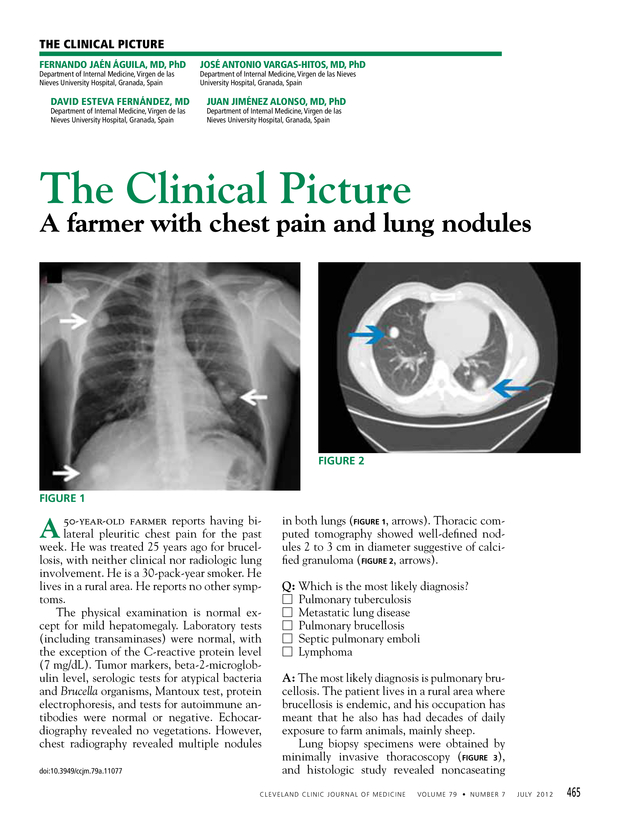 PDF extract preview