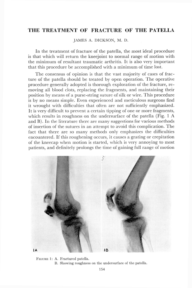 PDF extract preview