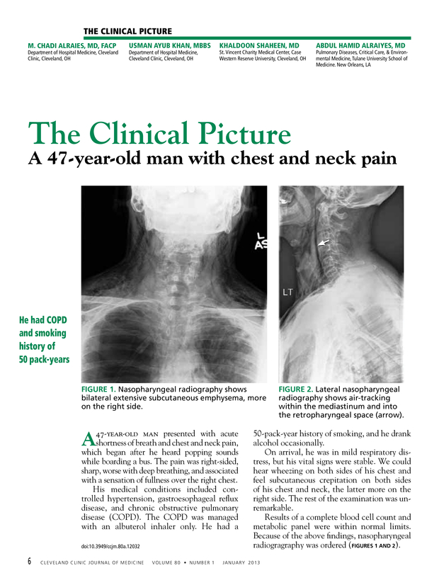 PDF extract preview