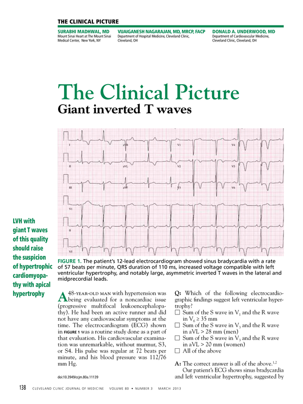 PDF extract preview
