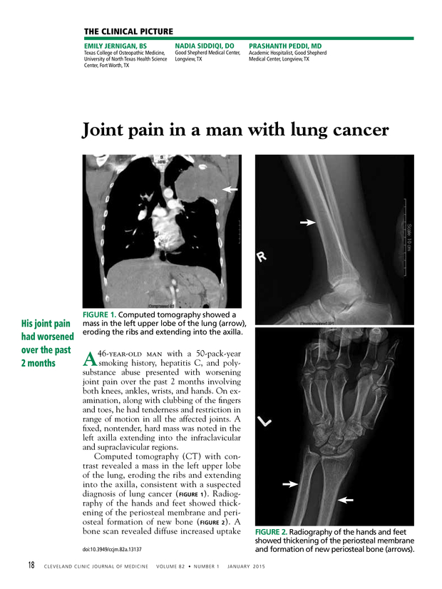 PDF extract preview