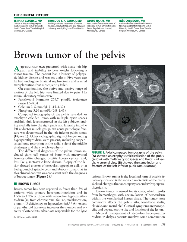 PDF extract preview