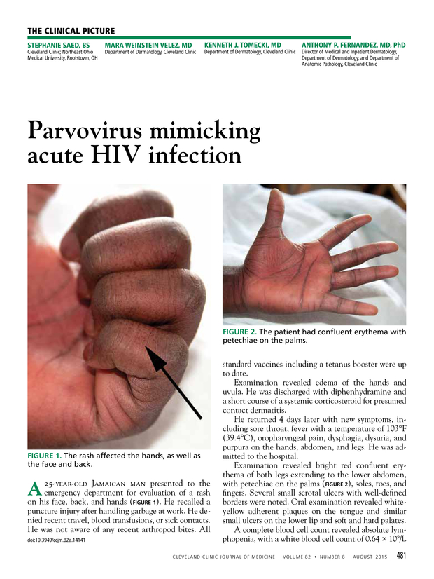 PDF extract preview