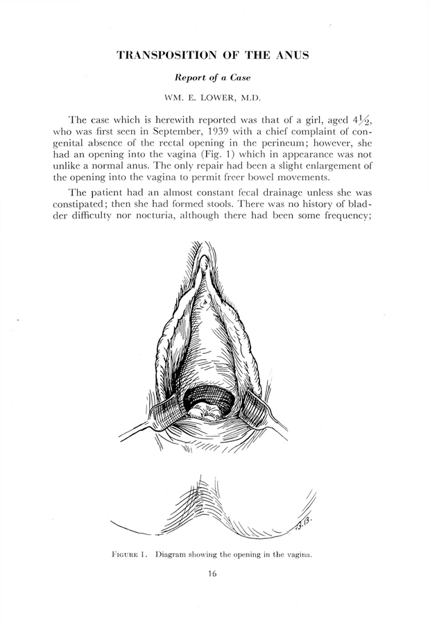 PDF extract preview