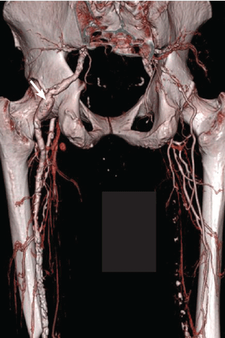 FIGURE 3