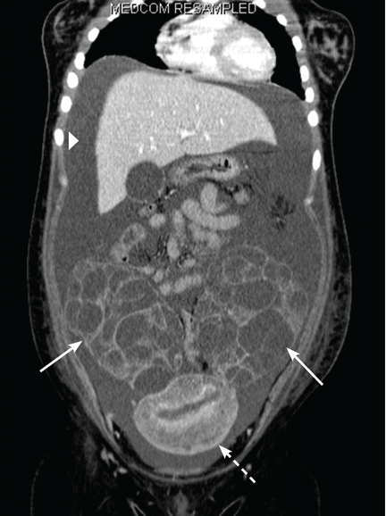 FIGURE 2