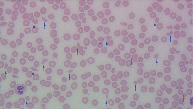 FIGURE 1