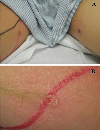 FIGURE 1