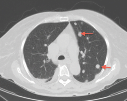 FIGURE 1