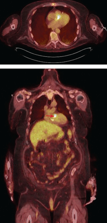 Figure 1C