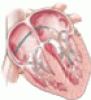 The challenge of valvular heart disease: When is it time to operate?
