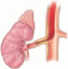 Renovascular hypertension: Balancing the controversies in diagnosis and treatment