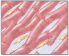 Cardiovascular complications of systemic sclerosis: What to look for