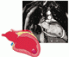 MRI of the heart: Promises fulfilled?