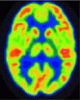 PET and PET/CT imaging: What clinicians need to know