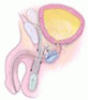 Evaluating and managing urinary incontinence after prostatectomy: Beyond pads and diapers
