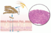 Celiac disease: Managing a multisystem disorder