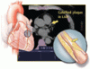 Coronary artery calcium scoring: Its practicality and clinical utility in primary care
