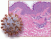 Update in cutaneous manifestations of COVID-19: Special populations