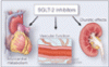 SGLT-2 inhibitors in heart failure and chronic kidney disease: A review for internists