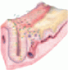 <em>Clostridium difficile</em>-associated disease: New challenges from an established pathogen