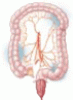 Investigation and management of ischemic colitis