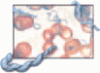 Blood smear analysis in babesiosis, ehrlichiosis, relapsing fever, malaria, and Chagas disease