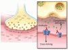 Myasthenia gravis: Newer therapies offer sustained improvement