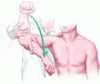 The painful shoulder: When to inject and when to refer