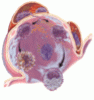 Our new understanding of pulmonary alveolar proteinosis: What an internist needs to know