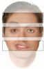 Bell palsy: Clinical examination and management