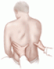 Diagnostic value of the physical examination in patients with dyspnea