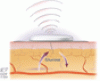 Diabetes technology: A primer for clinicians