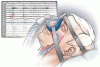 Sleep apnea ABCs: Airway, breathing, circulation