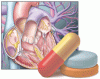 What antithrombotic therapy should I use for my patient with atrial fibrillation who underwent percutaneous coronary intervention or had an acute coronary syndrome?