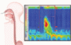 A man with progressive dysphagia