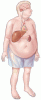 Long-term management of liver transplant recipients: A review for the internist