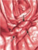 Whole-body CT screening for cancer and coronary disease: Does it pass the test?