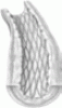 Drug-eluting stents: The beginning of the end of restenosis?