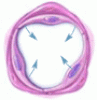 Treating pulmonary arterial hypertension: Cautious hope in a deadly disease